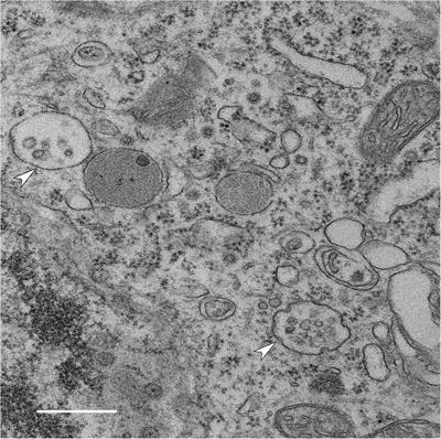 Exosome Production Is Key to Neuronal Endosomal Pathway Integrity in Neurodegenerative Diseases